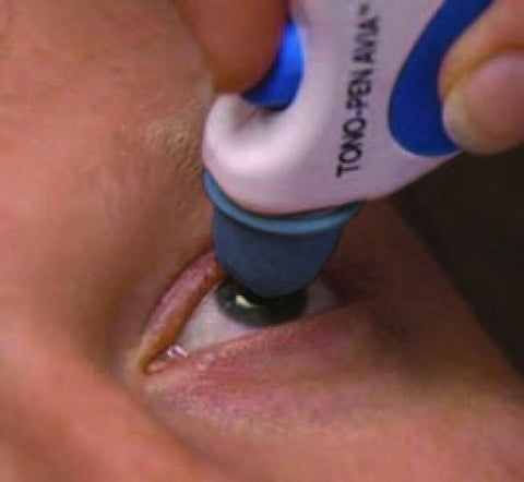 PRESIÓN INTRAOCULAR (PIO)